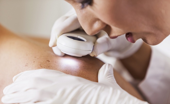 Why You Should Visit the Skin Cancer Clinic